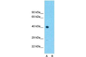 Western Blotting (WB) image for anti-Atonal Homolog 1 (Drosophila) (ATOH1) (Middle Region) antibody (ABIN2779592)