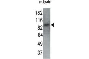 Western Blotting (WB) image for anti-MAP/microtubule Affinity-Regulating Kinase 1 (MARK1) antibody (ABIN2995250) (MARK1 抗体)