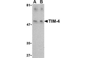 Image no. 1 for anti-T-Cell Immunoglobulin and Mucin Domain Containing 4 (TIMD4) (C-Term) antibody (ABIN318767) (TIMD4 抗体  (C-Term))