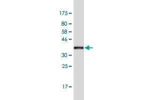 Western Blot detection against Immunogen (37. (LRGUK 抗体  (AA 721-825))