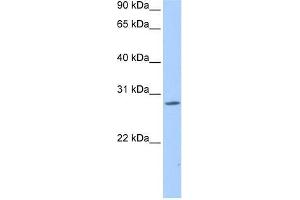 NRIP3 antibody used at 0. (NRIP3 抗体  (Middle Region))