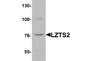 Western blot analysis of LZTS2 in human kidney tissue lysate with LZTS2 antibody at 1 µg/mL. (LZTS2 抗体  (N-Term))