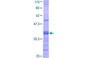 Image no. 1 for Microfibrillar-Associated Protein 4 (MFAP4) (AA 23-122) protein (GST tag) (ABIN1310790)