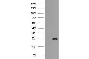 Image no. 1 for anti-RAB21, Member RAS Oncogene Family (RAB21) antibody (ABIN1500548) (RAB21 抗体)