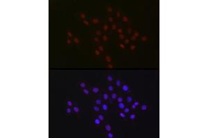 Immunofluorescence analysis of PC-12 cells using USP39 Rabbit mAb (ABIN7271160) at dilution of 1:100 (40x lens). (USP39 抗体)