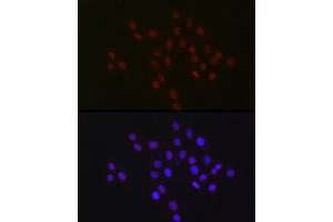 Immunofluorescence analysis of PC-12 cells using USP39 Rabbit mAb (ABIN7271160) at dilution of 1:100 (40x lens). (USP39 抗体)