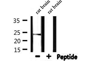 Western blot analysis of extracts from rat brain, using HSPB2 Antibody. (HSPB2 抗体  (Internal Region))