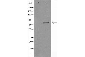 Western blot analysis of extracts from K562 cells, using SLC16A2 antibody. (SLC16A2/MCT8 抗体  (Internal Region))