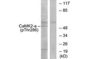 Western blot analysis of extracts from K562 cells, using CaMK2 (Phospho-Thr286) Antibody. (CAMK2B 抗体  (pThr286))