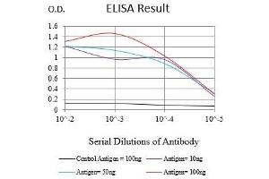 Black line: Control Antigen (100 ng),Purple line: Antigen (10 ng), Blue line: Antigen (50 ng), Red line:Antigen (100 ng) (KRT6A 抗体  (AA 253-352))