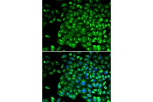 Immunofluorescence analysis of U2OS cells using TNFRSF1B antibody (ABIN5970147). (TNFRSF1B 抗体)