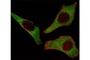 Fluorescent image of HeLa cells stained with CDK4 antibody at 1:25.