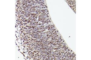 Immunohistochemistry of paraffin-embedded mouse fetal Brain using TET1 Rabbit pAb (ABIN3022030, ABIN3022031, ABIN3022032, ABIN1513597 and ABIN6218576) at dilution of 1:50 (40x lens). (TET1 抗体)