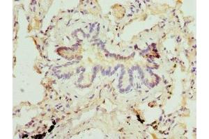 Immunohistochemistry of paraffin-embedded human lung tissue using ABIN7159380 at dilution of 1:100 (MBTPS1 抗体  (AA 803-1052))
