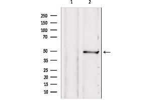 Western blot analysis of extracts from 293, using SUCLA2 antibody. (SUCLA2 抗体  (Internal Region))