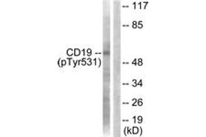Western blot analysis of extracts from COS7 cells treated with Serum 10% 30', using CD19 (Phospho-Tyr531) Antibody. (CD19 抗体  (pTyr531))