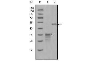 Western Blot showing Mammaglobin-1 antibody used against full-length GST- Mammaglobin-1 (1) and full-length MBP- Mammaglobin-1 (aa1-193) recombinant protein (2). (Mammaglobin A 抗体  (AA 1-193))