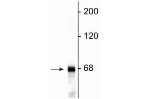 Western blot of rat cortical lysate showing specific immunolabeling of the ~68 kDa NF-L protein. (NEFL 抗体)