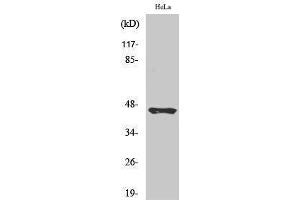 Western Blotting (WB) image for anti-Plasma Kallikrein HC (Arg390), (cleaved) antibody (ABIN3181850) (Plasma Kallikrein HC (Arg390), (cleaved) 抗体)