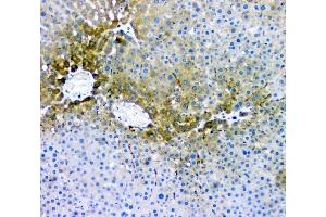 IHC analysis of RMI2 using anti-RMI2 antibody (ABIN6719656). (RMI2 抗体)
