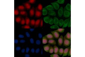 ABIN7096729 and ABIN7100794 staining Hela cells(45 min of heat-shock treatment) by IF/ICC. (ZNF382 抗体)