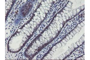 Image no. 1 for anti-SUMO1/sentrin/SMT3 Specific Peptidase 2 (SENP2) (AA 139-523) antibody (ABIN1490931) (SENP2 抗体  (AA 139-523))