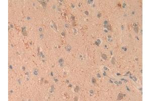Immunohistochemistry (IHC) image for anti-Complement Component 1, Q Subcomponent, A Chain (C1QA) (AA 28-245) antibody (ABIN7435415)