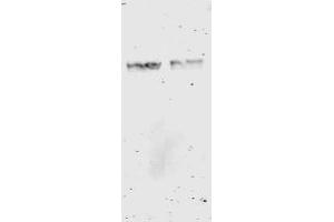 Western Blotting (WB) image for anti-Glutathione S Transferase (GST) antibody (ABIN400782) (GST 抗体)
