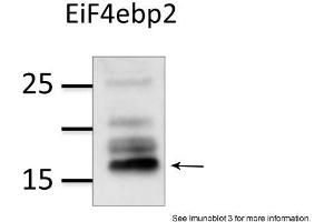 Sample Type: mouse brain extract (50ug)Primary Dilution: 1:1000Image Submitted by: Veronique DorvalLaval University, Canada . (eIF4EBP2 抗体  (N-Term))