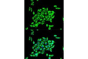 Immunofluorescence analysis of HeLa cell using TRAP1 antibody. (TRAP1 抗体)
