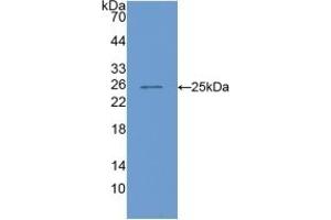 Detection of Recombinant COMP, Mouse using Polyclonal Antibody to Cartilage Oligomeric Matrix Protein (COMP) (COMP 抗体  (AA 554-753))
