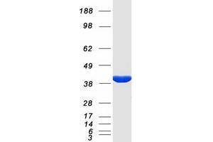 Western Blotting (WB) image for Potassium Voltage-Gated Channel, Shaker-Related Subfamily, beta Member 2 (KCNAB2) (Transcript Variant 1) protein (Myc-DYKDDDDK Tag) (ABIN2724015)
