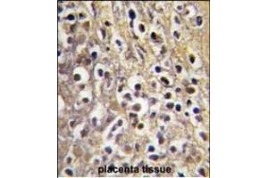 Formalin-fixed and paraffin-embedded human placenta tissue reacted with CYP19A1 antibody (C-term) (ABIN391826 and ABIN2841671) , which was peroxidase-conjugated to the secondary antibody, followed by DAB staining. (Aromatase 抗体  (C-Term))