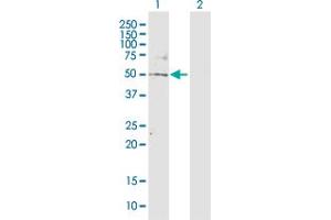 Western Blot analysis of TBL2 expression in transfected 293T cell line by TBL2 MaxPab polyclonal antibody. (TBL2 抗体  (AA 1-447))