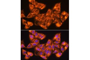 Immunofluorescence (IF) image for anti-Zinc Finger, CCHC Domain Containing 11 (ZCCHC11) (AA 1-290) antibody (ABIN6150406)