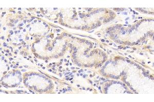 Detection of CASP7 in Human Stomach Tissue using Polyclonal Antibody to Caspase 7 (CASP7) (Caspase 7 抗体  (AA 207-303))