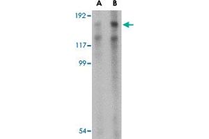 Western blot analysis of TARBP1 in NIH/3T3 cell lysate with TARBP1 polyclonal antibody  at (A) 1 and (B) 2 ug/mL . (TARBP1 抗体  (Internal Region))