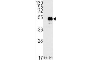 Western Blotting (WB) image for anti-Tumor Protein P53 (TP53) (AA 33-62) antibody (ABIN3029394)