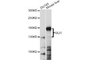 Western blot analysis of extracts of various cell lines, using GLI1 antibody. (GLI1 抗体)