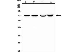 Western blot analysis of HIF3A using anti-HIF3A antibody (ABIN7601137).