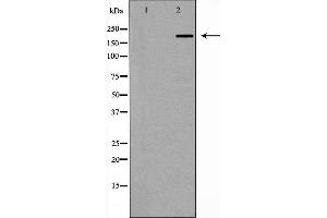 Western blot analysis of ZO 1 expression in Human brain,The lane on the left is treated with the antigen-specific peptide. (TJP1 抗体)