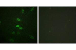 Peptide - +Immunofluorescence analysis of HeLa cells, using CDC25B (Ab-353) antibody. (CDC25B 抗体  (Ser353))