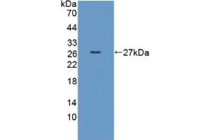 Western blot analysis of recombinant Human TPMT. (TPMT 抗体  (AA 26-227))