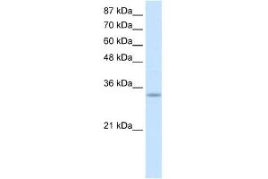 WB Suggested Anti-PRKRA Antibody Titration:  0. (PRKRA 抗体  (Middle Region))