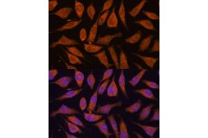 Immunofluorescence analysis of L929 cells using SMYD3 antibody (ABIN7270260) at dilution of 1:100. (SMYD3 抗体  (AA 50-150))