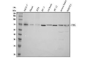 Western blot analysis of TPBG using anti-TPBG antibody (ABIN7825991).