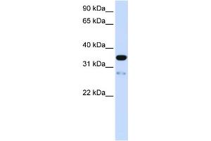 WB Suggested Anti-TMEM38A Antibody Titration:  0. (TMEM38A 抗体  (N-Term))