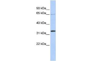 WB Suggested Anti-GRHL2 Antibody Titration:  1 ug/ml  Positive Control:  721_B cell lysate (GRHL2 抗体  (Middle Region))