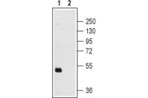 Western blot analysis of human platelets:1.