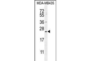 FA Antibody (N-term) (ABIN656101 and ABIN2845443) western blot analysis in MDA-M cell line lysates (35 μg/lane). (FAM109A 抗体  (N-Term))